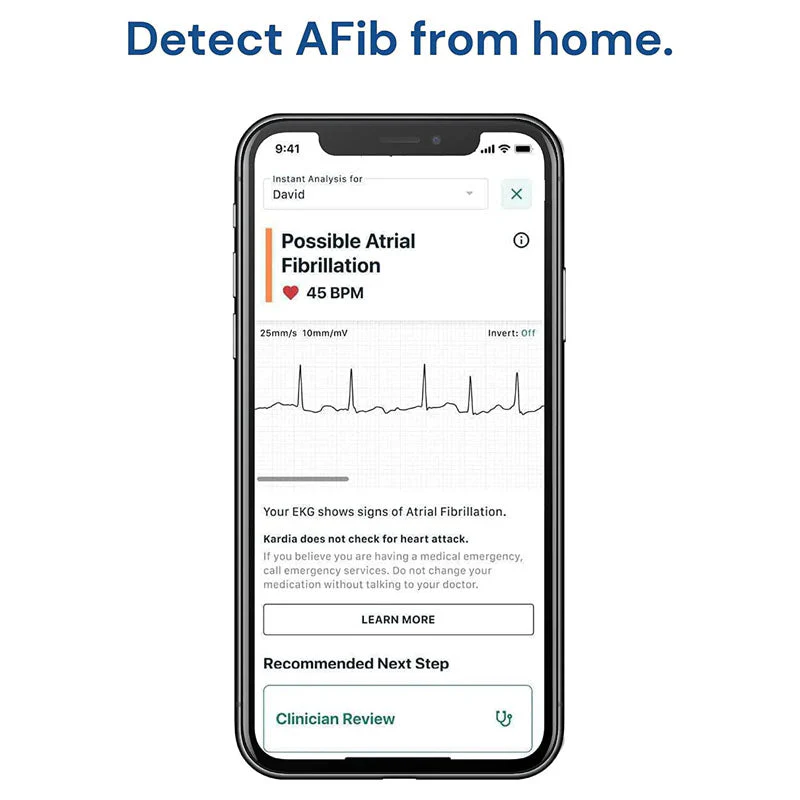 AliveCor KardiaMobile Smart ECG/EKG and Heart Monitor - Image 4