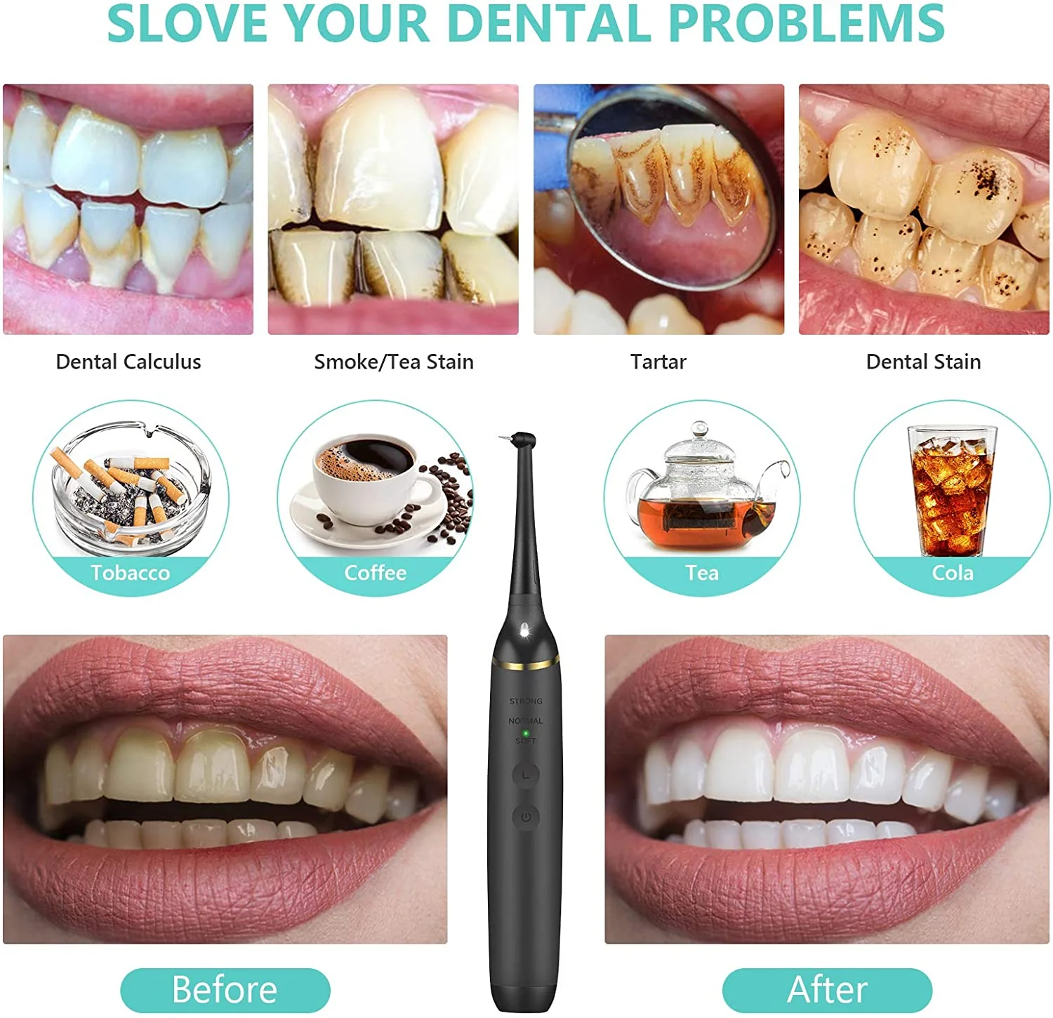 Electric Dental Calculus Remover Tooth Cleaner - Image 5