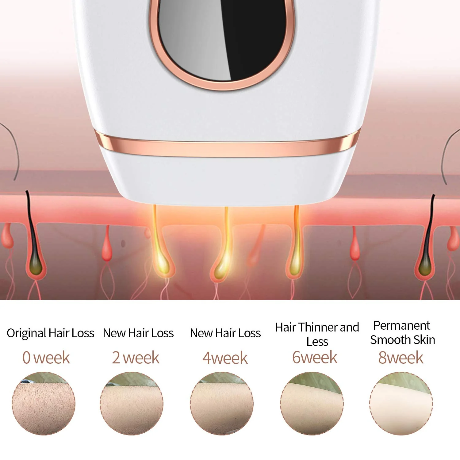 IPL Hair Removal System, Permanent Painless 999,999 Flashes - Image 3