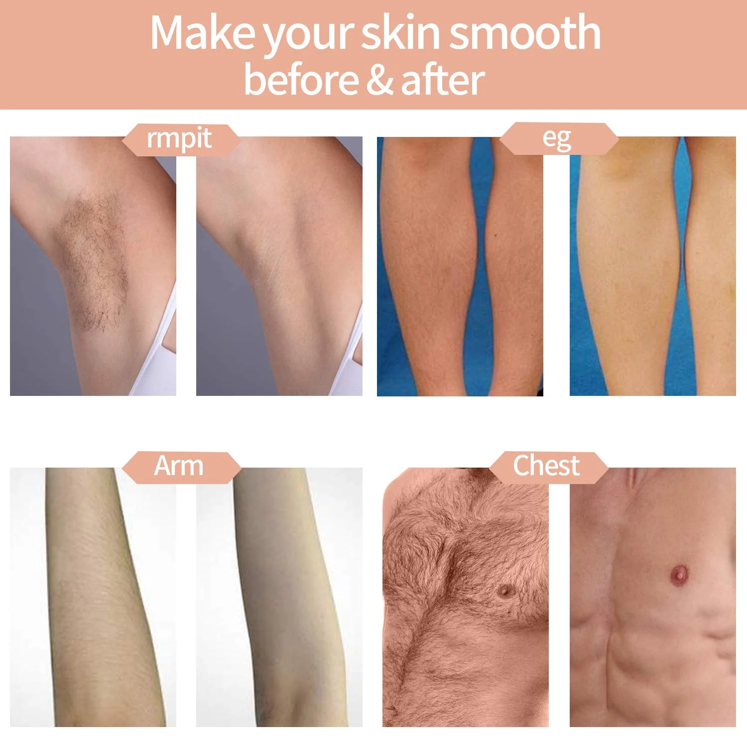 IPL Hair Removal System, Permanent Painless 999,999 Flashes - Image 7