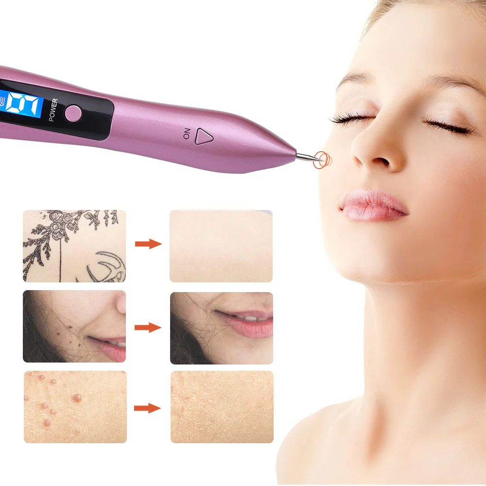 Skin Spot Removal Pen Plasma Pen - Image 8